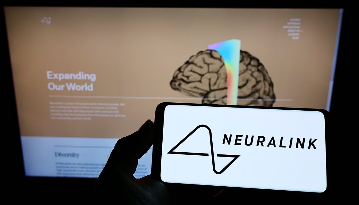 Neuralink